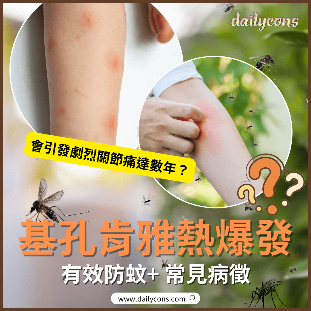 認識基孔肯雅熱症狀、與登革熱差異和防蚊措施